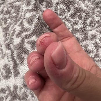 Vennetian Nails - Terrible dip nail job today - Nail Salons Near Me - Tyler, Texas Vennetian Nails - Terrible dip nail job today - Nail Salons Near Me - Tyler, Texas