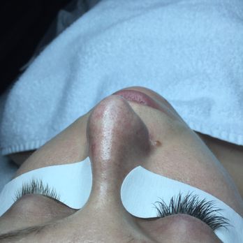 Tiffany’s Touch - My before & after! Amazing work! Great place to go! - Skin Care Near Me - Stockton, California Tiffany’s Touch - My before & after! Amazing work! Great place to go! - Skin Care Near Me - Stockton, California