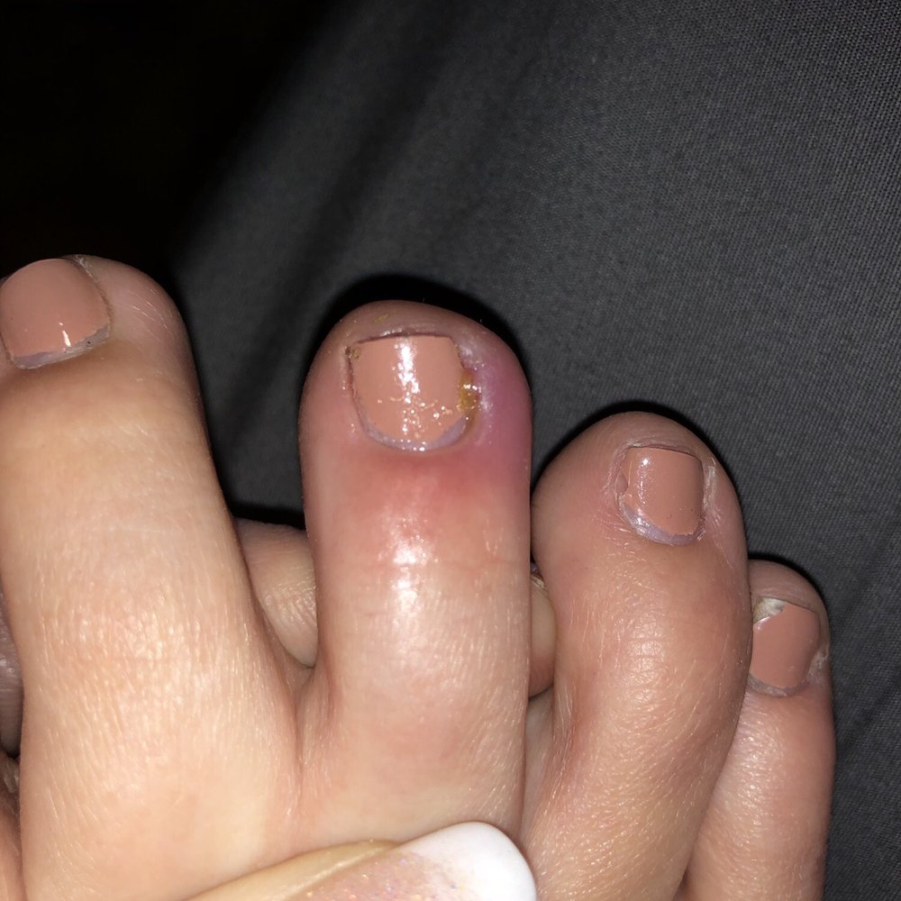 Fancy Nails - Two days after - Nail Salons Near Me - Phoenix, Arizona Fancy Nails - Two days after - Nail Salons Near Me - Phoenix, Arizona