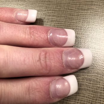 Luxury Nails and Spa - Horrible French acrylic manicure rebase job - Nail Salons Near Me - Castle Rock, Colorado Luxury Nails and Spa - Horrible French acrylic manicure rebase job - Nail Salons Near Me - Castle Rock, Colorado