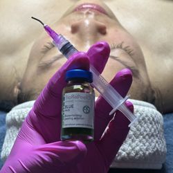 Siesta Esthetics - BioRePeel