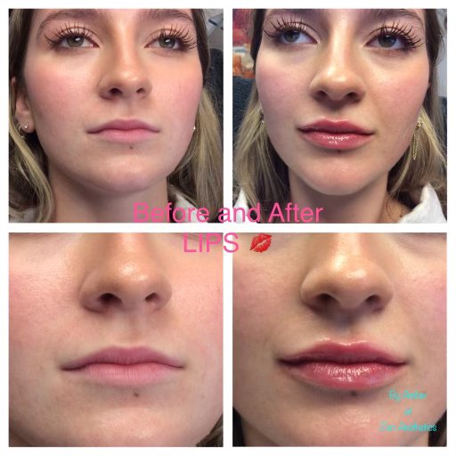 ZEN AESTHETICS AND WELLNESS 170 Photos & 31 Reviews 122 N Bryant Ave, Edmond, Oklahoma