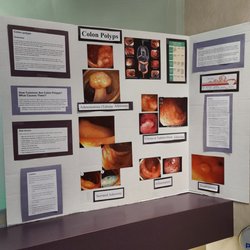 MercyOne Clive Endoscopy