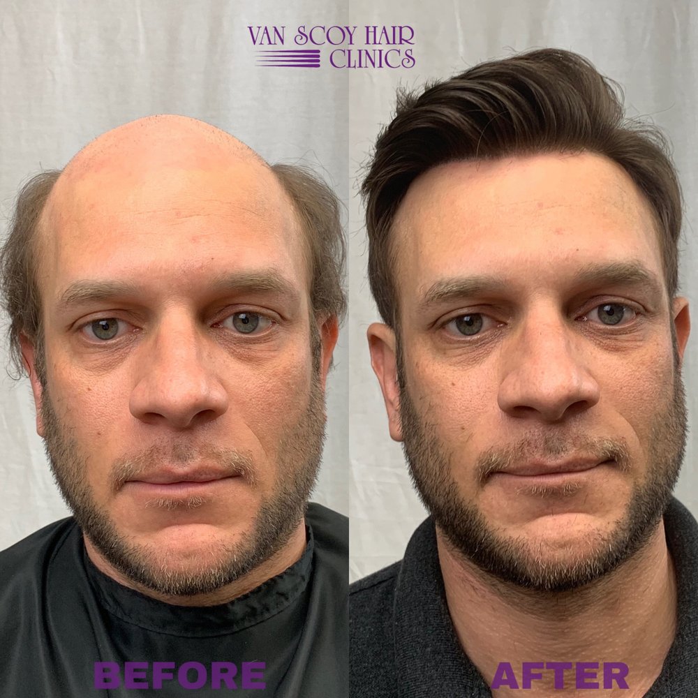 VAN SCOY HAIR CLINICS 11 Photos 5592 Broadview Rd, Cleveland, Ohio Wigs Phone Number Yelp