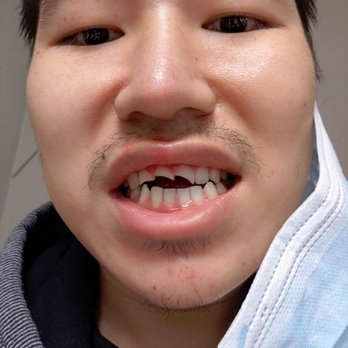 Yvonne Chen, DMD - Cosmetic Dentists Near Me - Fremont, California Yvonne Chen, DMD - Cosmetic Dentists Near Me - Fremont, California