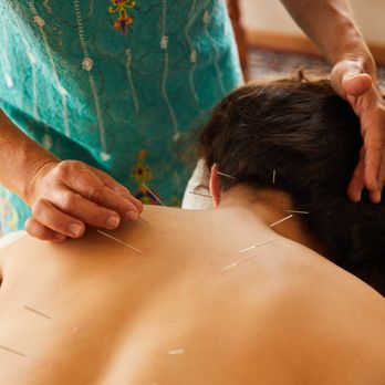 LightBody Acupuncture - Acupuncture Near Me - San Diego, California LightBody Acupuncture - Acupuncture Near Me - San Diego, California