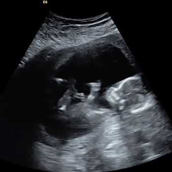The Baby Connection - So clear!! The ultrasound tech was sooo sweet and patient! - Diagnostic Imaging Near Me - Roseville, California