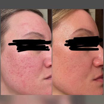 Allure Skin and Laser - Medical Spas Near Me - Granite Bay, California Allure Skin and Laser - Medical Spas Near Me - Granite Bay, California