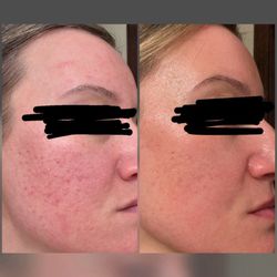 Allure Skin and Laser
