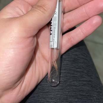 Veterinary Emergency Center - Foxtail that was found in my puppies ear. - Veterinarians Near Me - Redlands, California