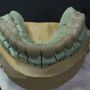 Hall Brothers Dental Lab