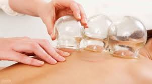 Acupuncture with cupping for low back pain relief - Common to see patients come in for chronic back pain that has been unresolved though they have tried physical therapy for months, with local steroid injections. They don't want to take pain medication and want to try acupuncture for pain relief. They have done X-rays and MRI to rule out the need for surgical intervention.
During our first session, we do a full in take to assess the.nature and the reasons for the back pain. In this case, it was disk herniation in the L3-L5 area and local muscle tightness that is causing the back pain, there is no referred pain nor numbness and the straight leg test was negative for nerve impignment.
We then proceeded to needling the local area and also added needles down the sides of the hip and along the legs where the patient reports tenderness. Additional needles were added corresponding to where the relevant channels cross. We applied TDP warming infrared light over the back area. The patient came back next week and reported the pain and reduced significantly by 70% since the treatment. We continue to work on the linger pain, adding cupping for one of the sessions along the low back area. The patient is prescribed topical patches to apply during the night and instructed to use heating pads to keep the area warm and improve circulation.
After 3 sessions the patient reports that pain is mostly eliminated and there is only minor tightness in the morning. Acupuncture with cupping for low back pain relief - Common to see patients come in for chronic back pain that has been unresolved though they have tried physical therapy for months, with local steroid injections. They don't want to take pain medication and want to try acupuncture for pain relief. They have done X-rays and MRI to rule out the need for surgical intervention.
During our first session, we do a full in take to assess the.nature and the reasons for the back pain. In this case, it was disk herniation in the L3-L5 area and local muscle tightness that is causing the back pain, there is no referred pain nor numbness and the straight leg test was negative for nerve impignment.
We then proceeded to needling the local area and also added needles down the sides of the hip and along the legs where the patient reports tenderness. Additional needles were added corresponding to where the relevant channels cross. We applied TDP warming infrared light over the back area. The patient came back next week and reported the pain and reduced significantly by 70% since the treatment. We continue to work on the linger pain, adding cupping for one of the sessions along the low back area. The patient is prescribed topical patches to apply during the night and instructed to use heating pads to keep the area warm and improve circulation.
After 3 sessions the patient reports that pain is mostly eliminated and there is only minor tightness in the morning.