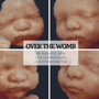 Photo of Over the Womb 4D Ultrasound & Photography