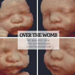 Over the Womb 4D Ultrasound & Photography - 4D live realistic view 28-32 weeks.