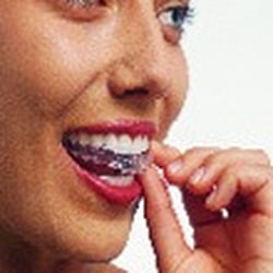Stewart C Brody, DDS - Invisalign