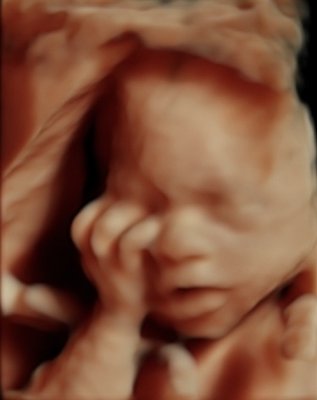 3D/4D/HD Elective Ultrasound Imaging - Services Provided:
High-resolution 3D, 4D, and HD ultrasound sessions for expecting parents
Real-time video viewing of baby’s movements, facial features, and activities
Digital files and printed photos included with every session
Heartbeat recording available to take home in a keepsake plush
Family-friendly, spacious viewing rooms (guests welcome)
Same-day appointments and quick, convenient session times
Benefits:
See baby in exceptional detail before delivery
Enjoy peace of mind with non-medical, safe imaging
Share digital files instantly with loved ones
Create lasting memories with unique, customizable keepsakes 3D/4D/HD Elective Ultrasound Imaging - Services Provided:
High-resolution 3D, 4D, and HD ultrasound sessions for expecting parents
Real-time video viewing of baby’s movements, facial features, and activities
Digital files and printed photos included with every session
Heartbeat recording available to take home in a keepsake plush
Family-friendly, spacious viewing rooms (guests welcome)
Same-day appointments and quick, convenient session times
Benefits:
See baby in exceptional detail before delivery
Enjoy peace of mind with non-medical, safe imaging
Share digital files instantly with loved ones
Create lasting memories with unique, customizable keepsakes