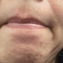 Chin