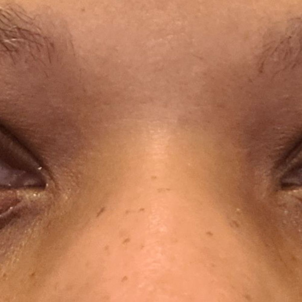 Amazing Lash Studio - Post lash lift... definitely not happy with the results - Eyelash Service Near Me - Manassas, Virginia Amazing Lash Studio - Post lash lift... definitely not happy with the results - Eyelash Service Near Me - Manassas, Virginia