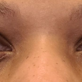 Amazing Lash Studio - Post lash lift... definitely not happy with the results - Eyelash Service Near Me - Manassas, Virginia Amazing Lash Studio - Post lash lift... definitely not happy with the results - Eyelash Service Near Me - Manassas, Virginia