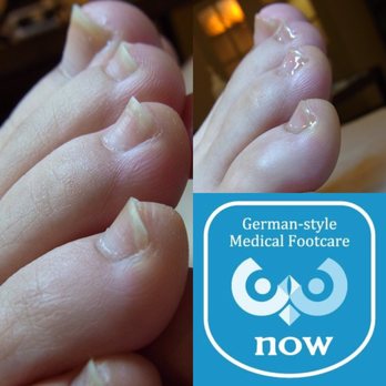 メディカルフットケアｎｏｗ 45 Photos Reflexology 本駒込6 15 8 文京区 東京都 Japan Phone Number