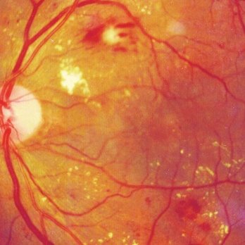 Master Eye  - We provide special care to diabetic patients. - Optometrists Near Me - Austin, Texas
