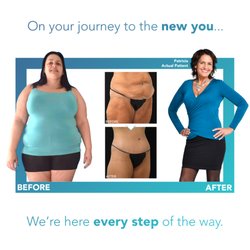 NYBG Plastic Surgery - Nassau County - Before and After Lower Body Lift