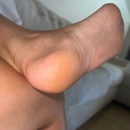 Right foot