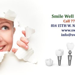 Smile Well Dental Implant