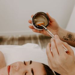 Evolve Esthetics - Chemical Peel