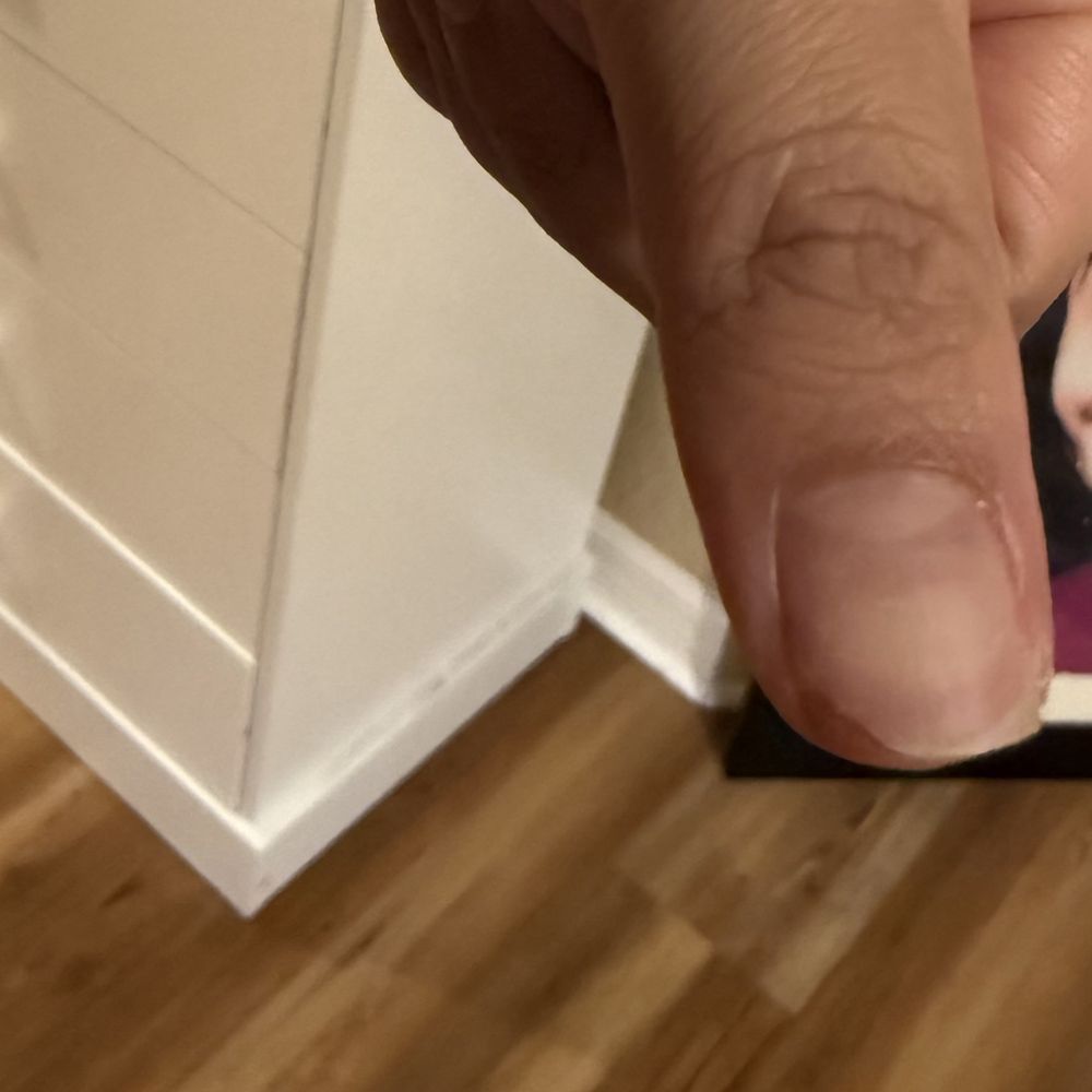 Viva Nail & Spa - Part of my real nail was ripped off, exposing the nail bed. It's been so painful. - Nail Salons Near Me - Ocala, Florida Viva Nail & Spa - Part of my real nail was ripped off, exposing the nail bed. It's been so painful. - Nail Salons Near Me - Ocala, Florida