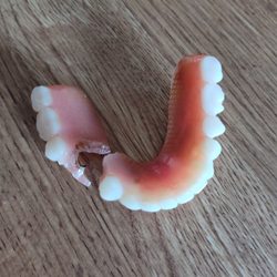 Albany County Dental Associates - Lasted one year 30k