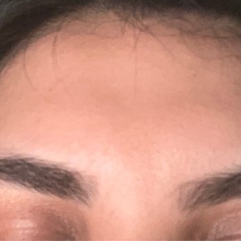 The Wax Room - After (2 days) - Threading Services Near Me - Laguna Hills, California The Wax Room - After (2 days) - Threading Services Near Me - Laguna Hills, California