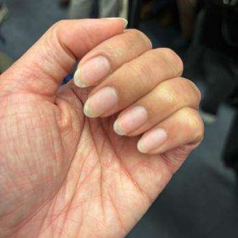 Alsa nail and spa - Cleaned up nails post hard gel removal - Nail Salons Near Me - New York, New York Alsa nail and spa - Cleaned up nails post hard gel removal - Nail Salons Near Me - New York, New York