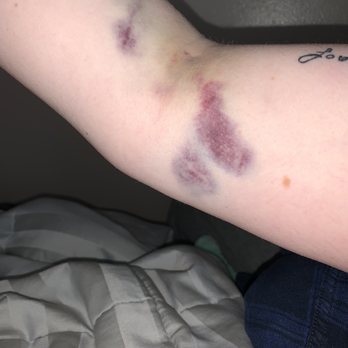 Biolife Plasma Services 12 Photos 39 Reviews Blood Plasma Donation Centers 3455 Quail Creek Dr Denton Tx Phone Number