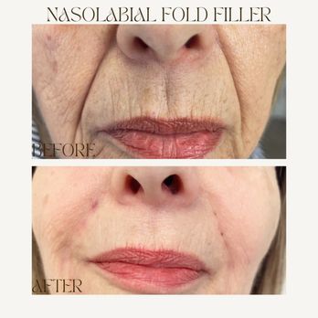 Hollywood Aesthetics - Aestheticians Near Me - Hollywood, Florida Hollywood Aesthetics - Aestheticians Near Me - Hollywood, Florida