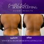 Photo of Beautiful Bodies Body Sculpting