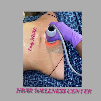 HBAR Wellness Center - Cavitation - Massage Near Me - Antioch, California HBAR Wellness Center - Cavitation - Massage Near Me - Antioch, California