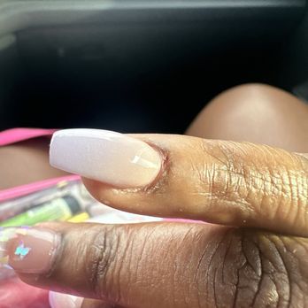Nail Lounge - My poor cuticle - Nail Salons Near Me - Addison, Texas Nail Lounge - My poor cuticle - Nail Salons Near Me - Addison, Texas