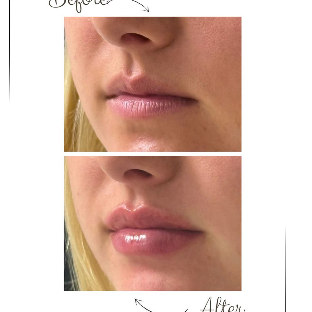 before and after b12 injections results TOP 10 BEST B12 INJECTIONS IN THOUSAND OAKS, CA - UPDATED 2026 - QUALITY & AFFORDABILITY