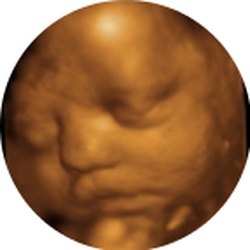The Ultrasound Zone