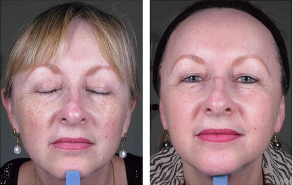 SERVICES - Patients of the practice can expect comprehensive care for both medical and aesthetic needs. The highly skilled dermatology team provides head-to-toe skin checks and monitors patients for skin cancer, mole changes, and skin discoloration. Practitioners even offer mole and skin cancer removal right in the office, including Mohs micrographic surgery.

The dermatologists also provide the latest and most advanced treatments for chronic skin conditions, including allergic dermatitis, psoriasis, eczema, and rosacea, to name just a few. Patients can get a full spectrum of cosmetic dermatology services, such as Botox®, dermal fillers, and laser skin resurfacing.