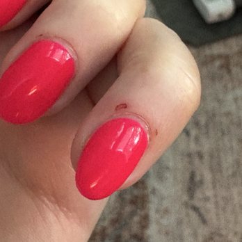Hanna's Nails - Cuticles cut pretty bad - Nail Salons Near Me - West Chester, Pennsylvania Hanna's Nails - Cuticles cut pretty bad - Nail Salons Near Me - West Chester, Pennsylvania