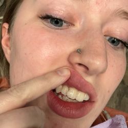 Tina M Marshall, DDS - The hole they left in my tooth