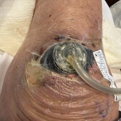 Stormont Vail Hospital - Knee surgery