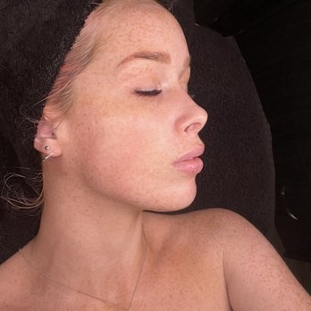 Kianaco Aesthetics - This treatment was like having a facelift - Estheticians Near Me - Plano, Texas Kianaco Aesthetics - This treatment was like having a facelift - Estheticians Near Me - Plano, Texas