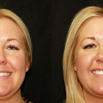 Intermountain Smiles - Cosmetic Dentists Near Me - Sandy, Utah