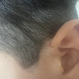Cut on ear Cut on ear