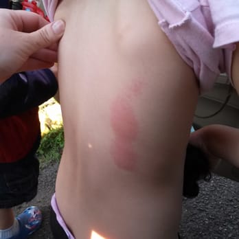 A Child's World - Child Abuse Incident 06/10/2015 - Child Care & Day Care Near Me - Bayonne, New Jersey A Child's World - Child Abuse Incident 06/10/2015 - Child Care & Day Care Near Me - Bayonne, New Jersey