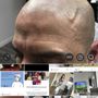 Scalp Aesthetics Micropigmentation Studio At Chase Tower