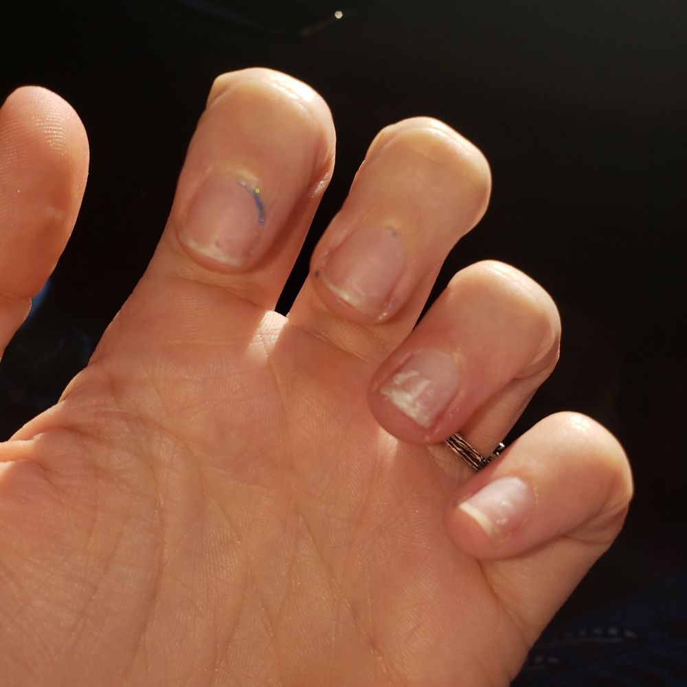 T & Y Nail Spa - 3 hours after getting acrylics, they have all fallen off. They wont refund me, offered to fix but I never want to step foot in this salon - Nail Salons Near Me - Peoria, Arizona T & Y Nail Spa - 3 hours after getting acrylics, they have all fallen off. They wont refund me, offered to fix but I never want to step foot in this salon - Nail Salons Near Me - Peoria, Arizona